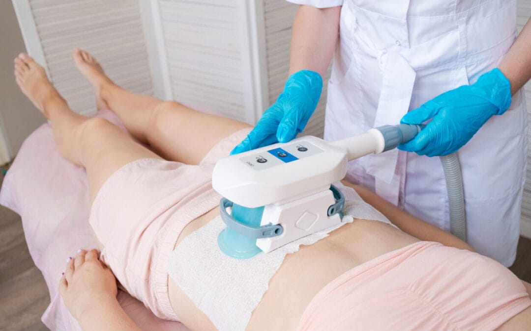 5 Benefits of CoolSculpting and Why It’s the Next Best Noninvasive Beauty Procedure