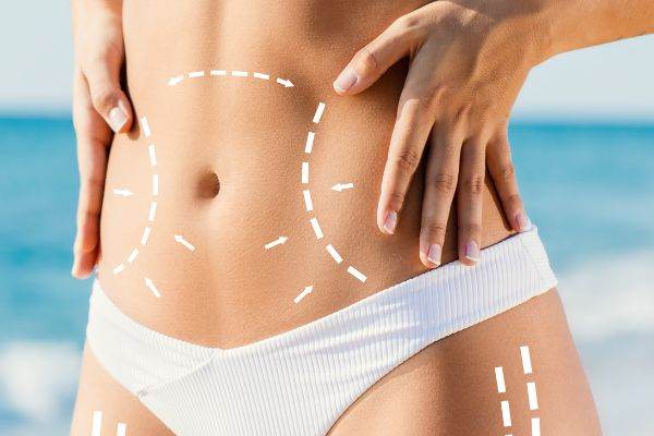 How Long Do Body Contouring Results Last? Pacific Derm Answers