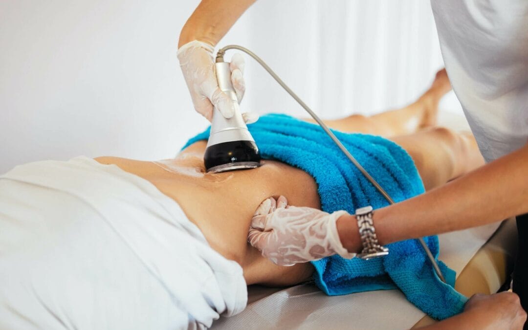 CoolSculpting vs Liposuction: What are the Differences?