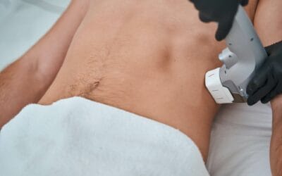 What to Know about CoolSculpting®: Do the Results Last?