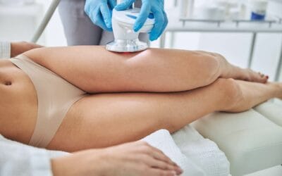 The Common Questions About CoolSculpting