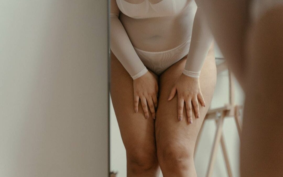 Dimple Dilemma: Understanding Cellulite Causes and Solutions