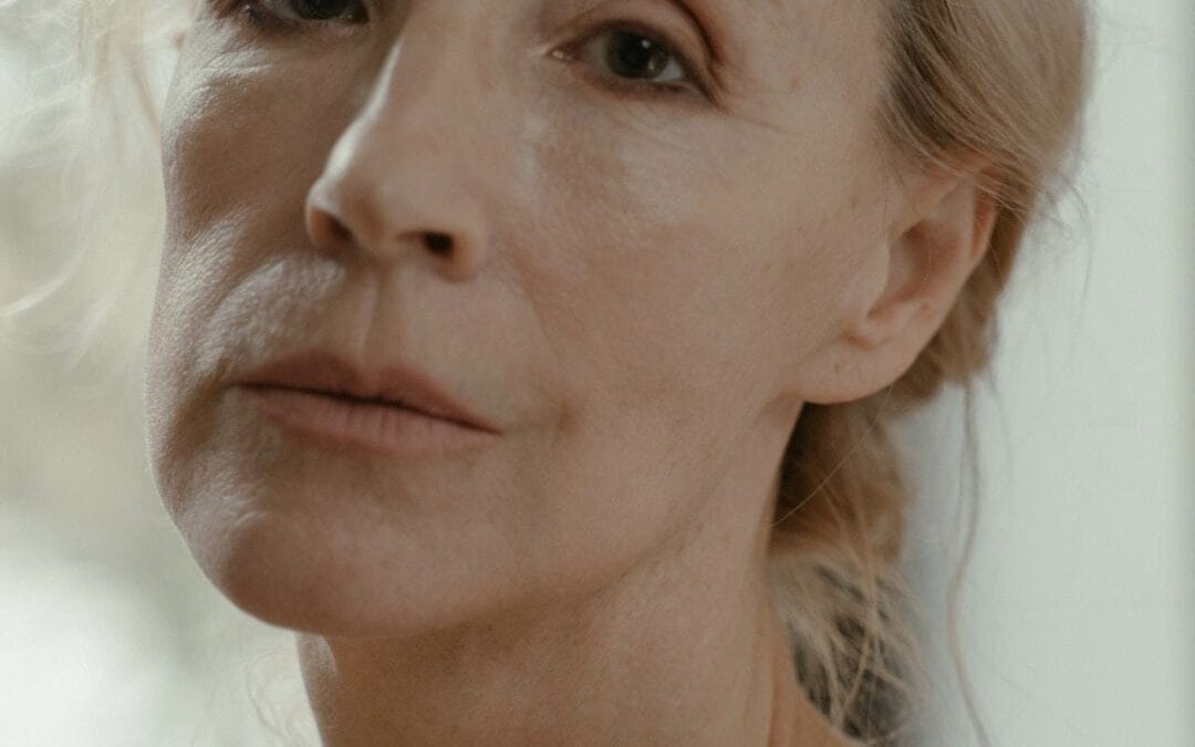 Beyond Wrinkles: 9 Surprising Benefits of Botox Treatment