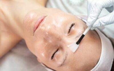 Enhance Your Skin’s Beauty with Chemical Peels at Dr. Melinda Silva’s Wellness Medical Spa