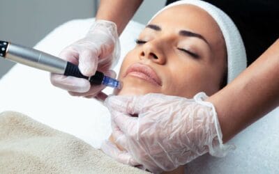 Enhancing Skin Health and Appearance: Discover the Benefits of Microneedling at Melinda Silva, MD