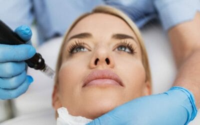 Transform Your Complexion with Microneedling at Melinda Silva, MD’s Medical Spa