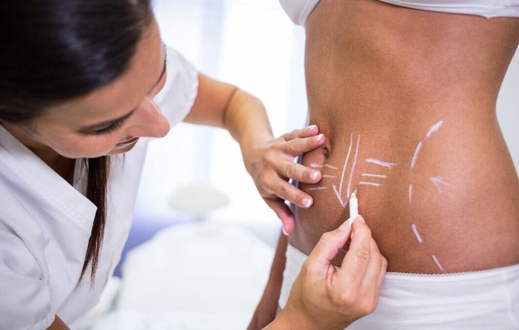 Discover the Power of CoolSculpting: Body Contouring at Melinda Silva, MD’s Wellness Medical Spa