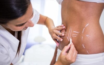 Discover the Power of CoolSculpting: Body Contouring at Melinda Silva, MD’s Wellness Medical Spa